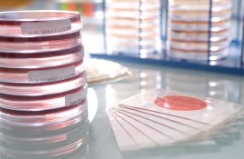 Aerobic Count Plates