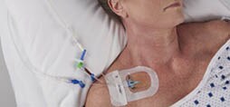 Stopping sepsis in its tracks
