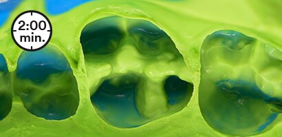 Regular set impression material
