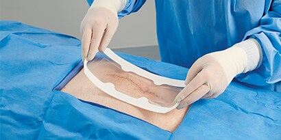 Post-operative dressing
