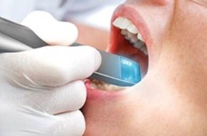 3M&trade; True Definition Scanner